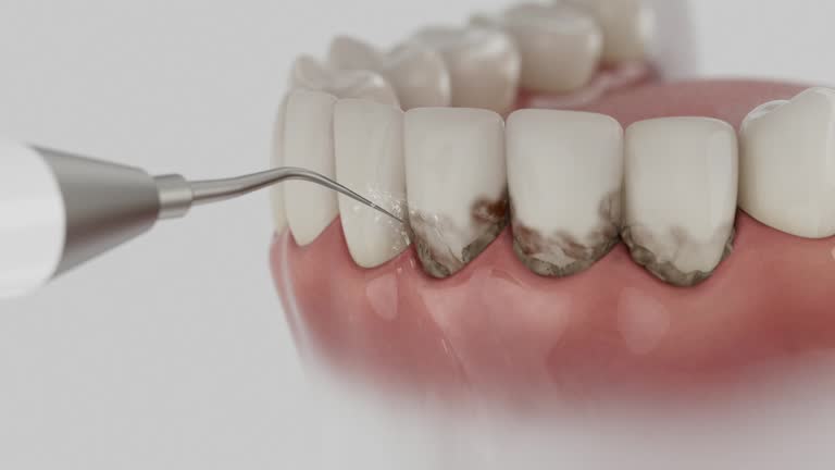 Reliable Dental contractor in Haskins, OH by Dentist Open Now